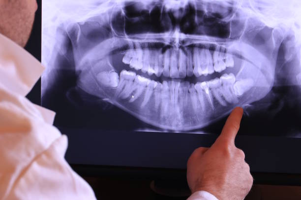 Best Walk-In Emergency Dental Services in Stevenson, WA